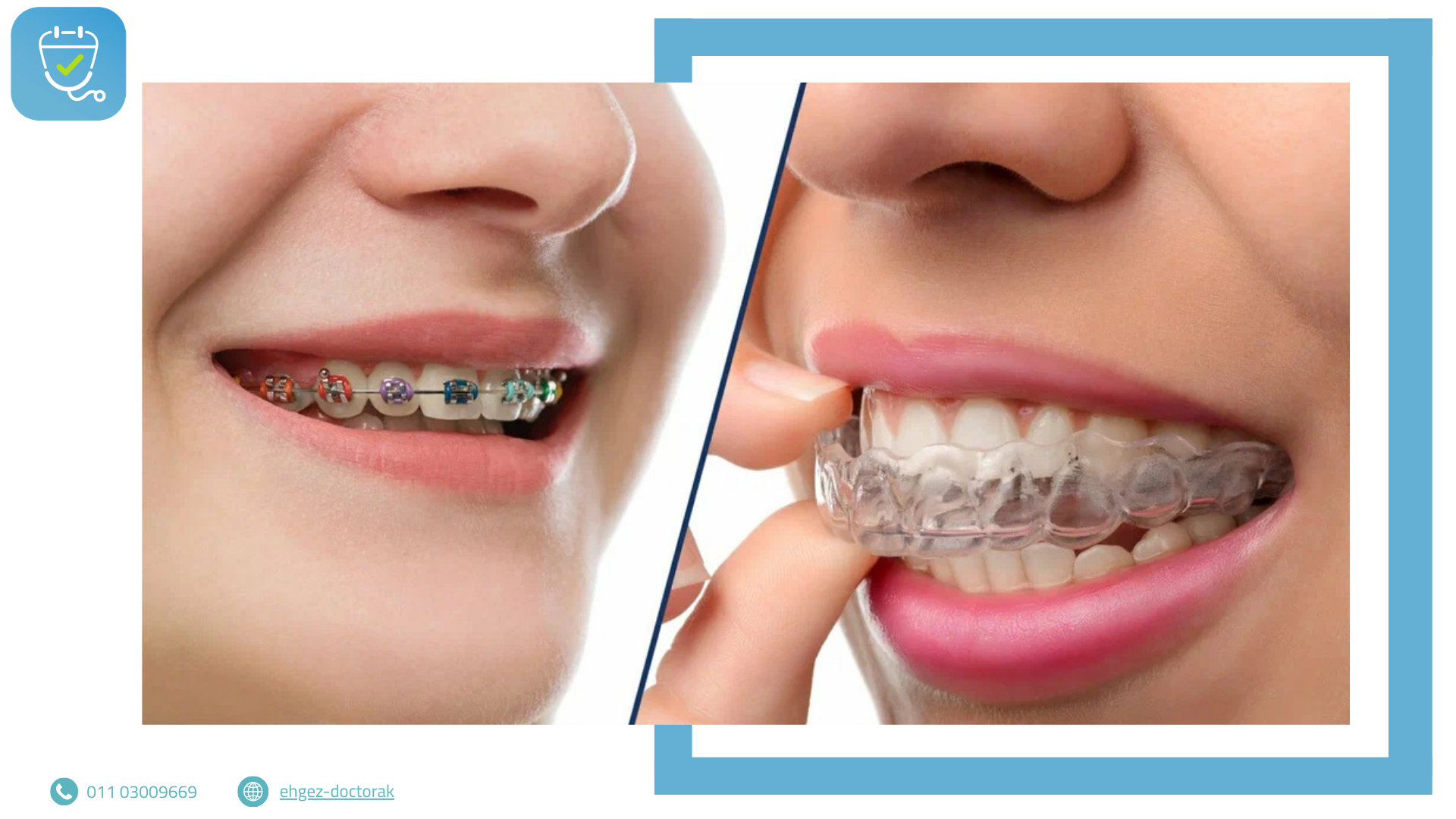 تقويم الأسنان